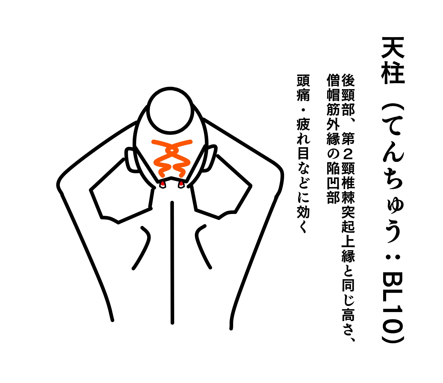 天柱
